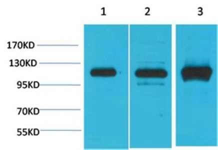 Western blot analysis of 1) 293T, 2) Mouse Brain Tissue, 3) Rat Brain Tissue with CaV α2δ2 Rabbit pAb diluted at 1:2,000.